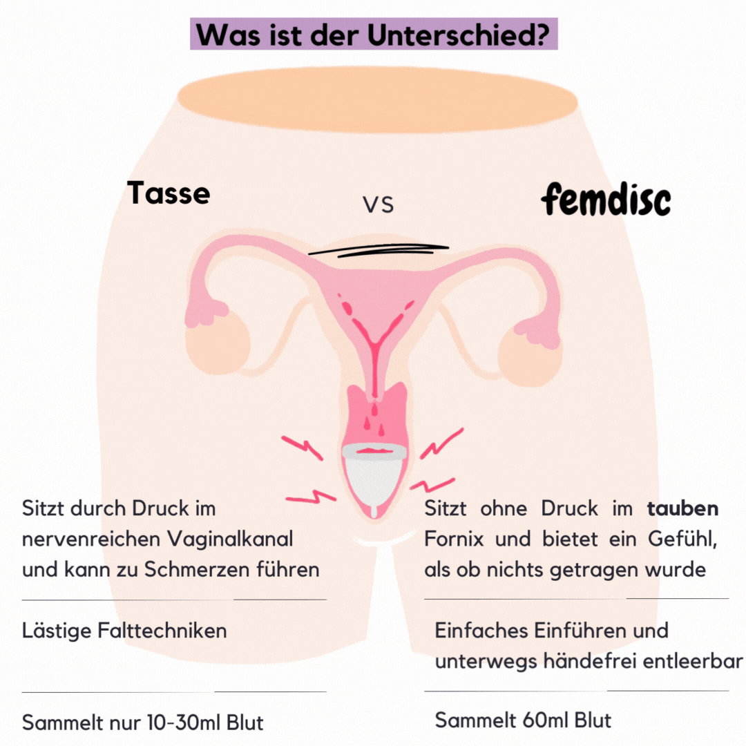 femdisc Einwegscheiben 5-Pack