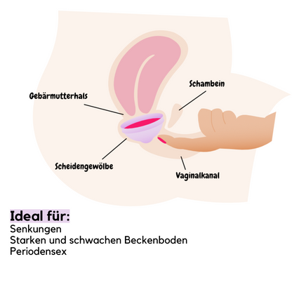 femdisc Einwegscheiben 10-Pack