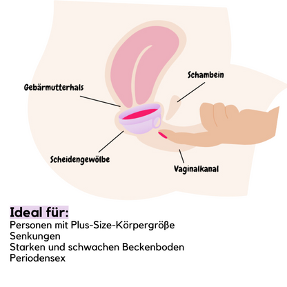 femdisc Menstruationsscheibe mit Lasche