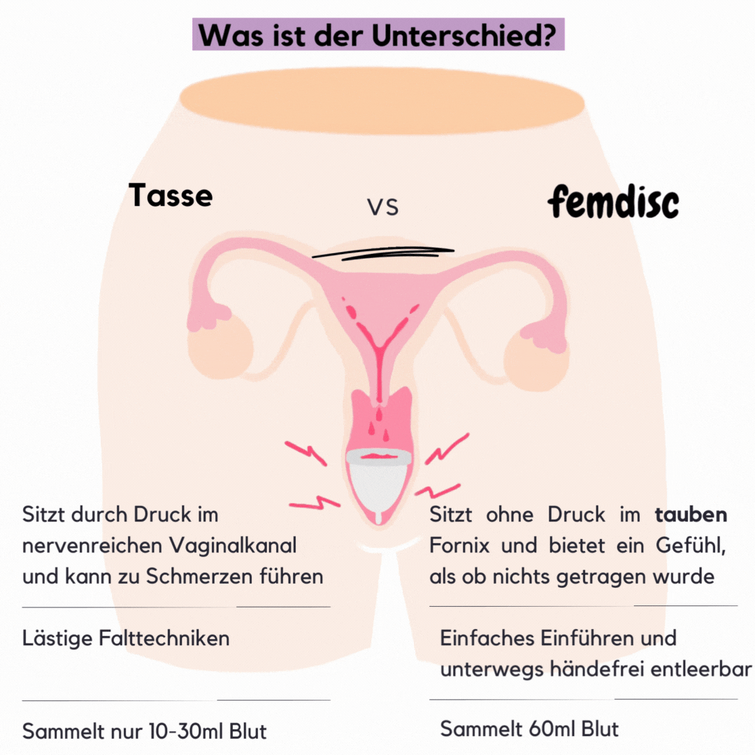femdisc Menstruationsscheibe mit Lasche